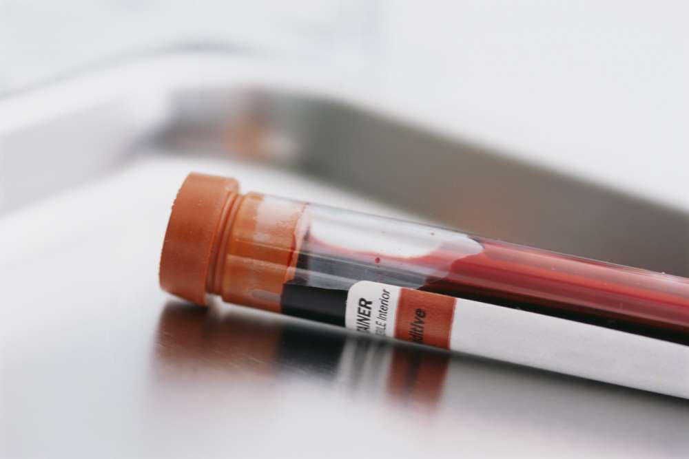 Συσκευή “Εργαστήριο-σε-ένα-τσιπ” θα μπορούσε να δίνει αποτελέσματα τεστ αίματος στο σπίτι σε μερικά λεπτά!