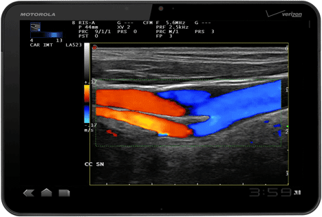 To Xoom ‘δείχνει’ το… υπερηχογράφημα!