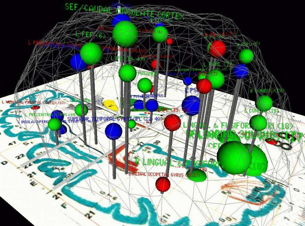 Ελβετοί και Γερμανοί επιστήμονες θέλουν να… φτιάξουν έναν εγκέφαλο – computer modelling