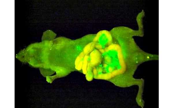 Καρκινικά κύτταρα που λαμπυρίζουν…