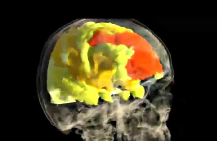 Το πρώτο βίντεο ‘εγκεφάλου’ για τον γυναικείο οργασμό…