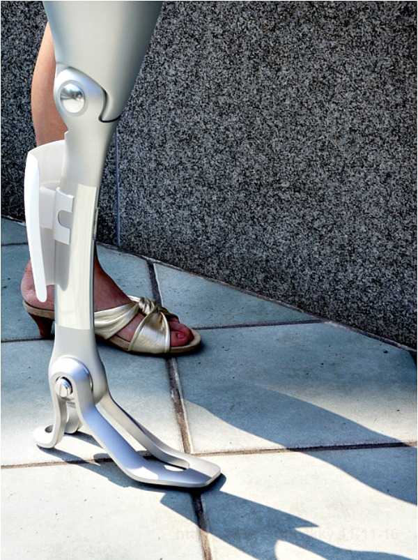 Μια προσθετική με αισθητική…