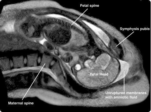 Το πρώτο βίντεο γέννας μέσα σε μαγνητικό!