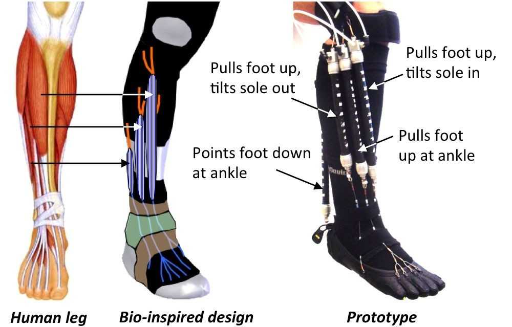OrthoticDesign final