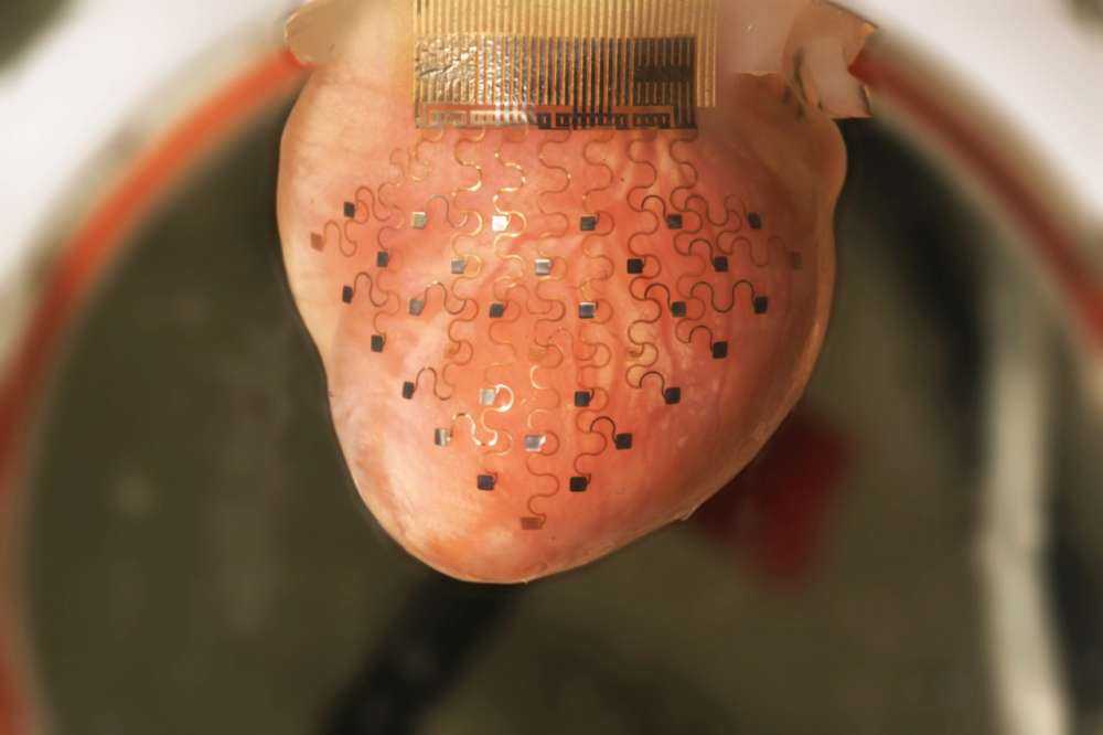 Οι 3D εκτυπωτές στην υπηρεσία της καρδιάς…