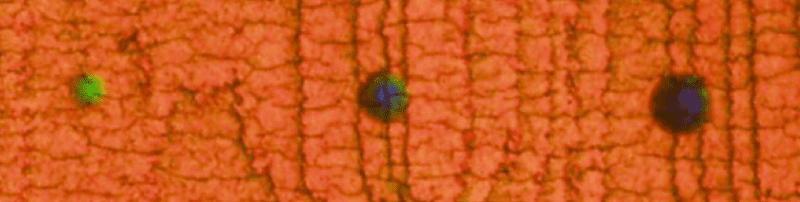 Κράνος που αλλάζει χρώμα ‘ειδοποιεί’ τους γιατρούς…