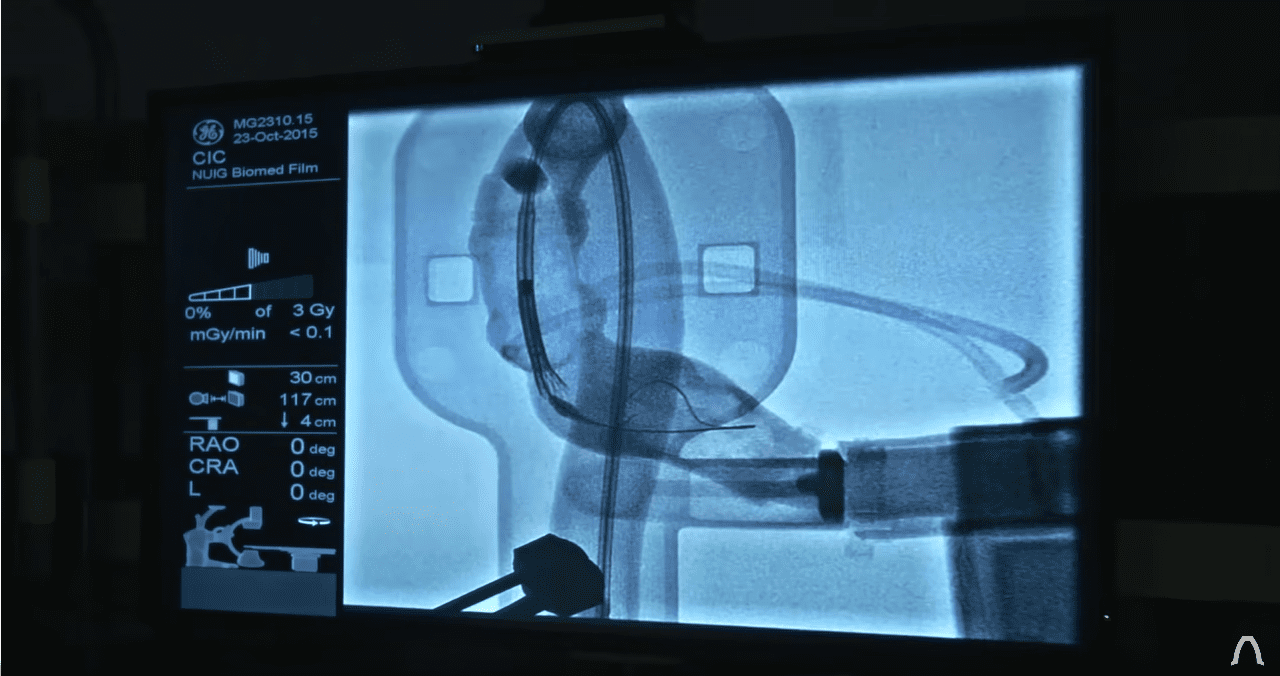 Σχεδιάζοντας χαμηλού κόστους αναπνευστήρες