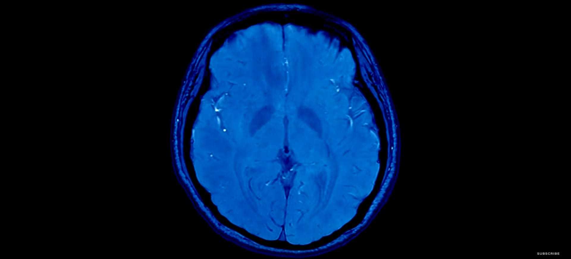 Τι είναι το neuromorphic computing