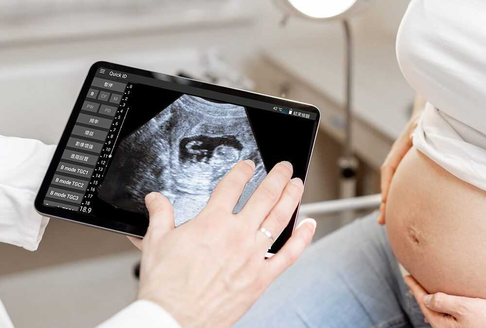 ASUS LU700 Portable Ultrasound Series